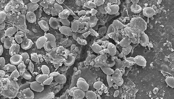 1660317493426 Fig1fungiinfestedplastic