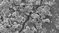 1660317493426 Fig1fungiinfestedplastic 1660317493426 Fig1fungiinfestedplastic