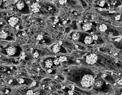 Microvi-MNE-SEM-copy Microvi-MNE-SEM-copy