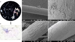 Figure 1. Photomicrograph of floating fibers collected from the coastal zone of the northwestern Mediterranean (A); scanning electron microscopy images of their bacterial communities (B); and with elongated and rounded cells as well as extracellular polymeric substances (C-F). Figure 1. Photomicrograph of floating fibers collected from the coastal zone of the northwestern Mediterranean (A); scanning electron microscopy images of their bacterial communities (B); and with elongated and rounded cells as well as extracellular polymeric substances (C-F).