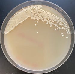 Figure 1. Researchers at the Joint BioEnergy Institute observed an engineered strain of the bacteria Streptomyces producing cyclopropanes, high-energy molecules that could potentially be used in the sustainable production of novel bioactive compounds and advanced biofuels. Figure 1. Researchers at the Joint BioEnergy Institute observed an engineered strain of the bacteria Streptomyces producing cyclopropanes, high-energy molecules that could potentially be used in the sustainable production of novel bioactive compounds and advanced biofuels.