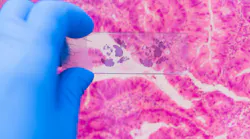 Study: Plastics Harbor Nearly Half of Known Breast Cancer-Linked Chemicals